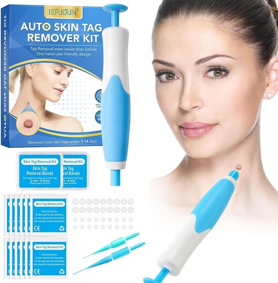 Средство для удаления бородавок и наростов на коже, инструмент, ручка, набор